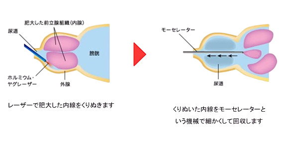 泌尿器外科 2021年9月号（Vol.34 No.9） – 医学図書出版